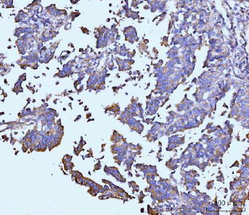 TARS2 Rabbit Polyclonal Antibody