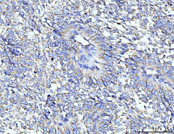 TARS2 Rabbit Polyclonal Antibody