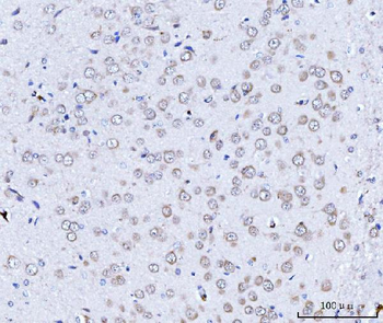 TARS2 Rabbit Polyclonal Antibody