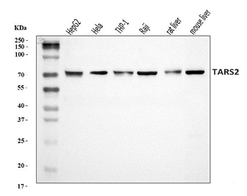 TARS2 Rabbit Polyclonal Antibody