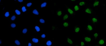 TRMT1 Rabbit Polyclonal Antibody