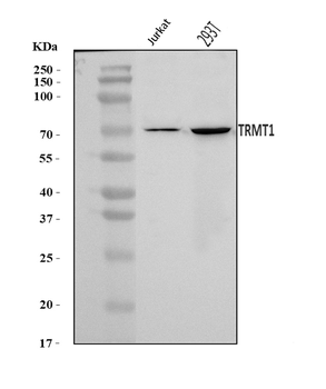 TRMT1 Rabbit Polyclonal Antibody