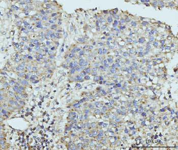 hUPF2/RENT2/UPF2 Rabbit Polyclonal Antibody