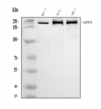 hUPF2/RENT2/UPF2 Rabbit Polyclonal Antibody