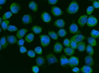 ZC3H7A Rabbit Polyclonal Antibody