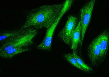 Filamin B/FLNB Antibody
