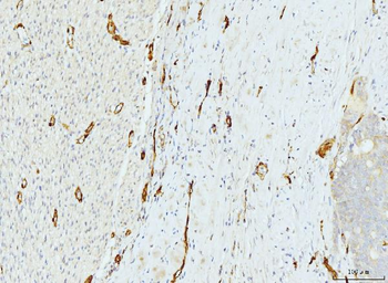 FABP4 Antibody (monoclonal, 10E12)