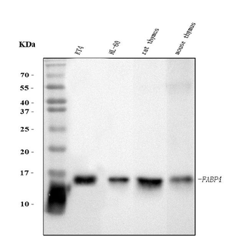FABP4 Antibody (monoclonal, 10E12)