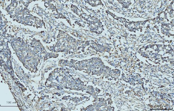 Cytokeratin 5 Antibody (monoclonal, 5D3F7)