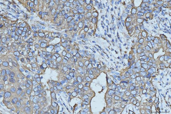 Cytokeratin 5 Antibody (monoclonal, 5D3F7)