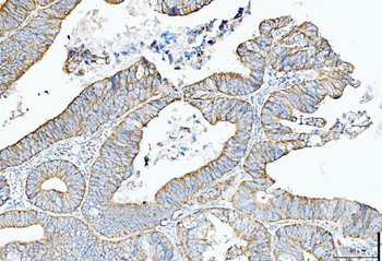 Cytokeratin 5 Antibody (monoclonal, 5D3F7)