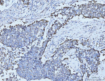 Cytokeratin 5 Antibody (monoclonal, 9H2F8)