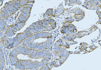 Cytokeratin 5 Antibody (monoclonal, 9H2F8)