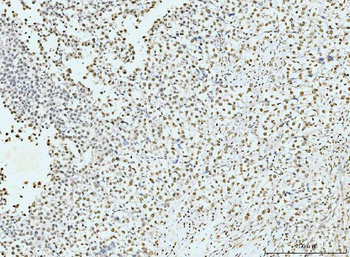 p95 NBS1 Mouse Monoclonal Antibody