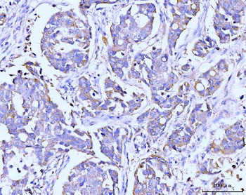 ITCH/AIP4 Mouse Monoclonal Antibody