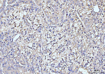ITCH/AIP4 Mouse Monoclonal Antibody