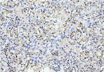 ITCH/AIP4 Mouse Monoclonal Antibody