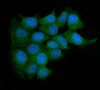 Acid phosphatase/ACP5 Antibody