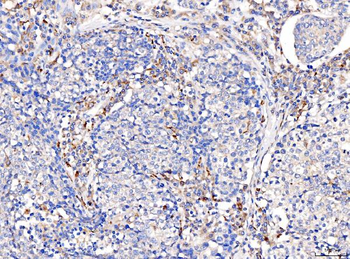 Acid phosphatase/ACP5 Antibody