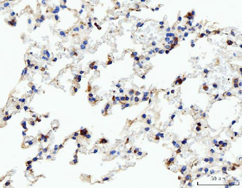 Acid phosphatase/ACP5 Antibody