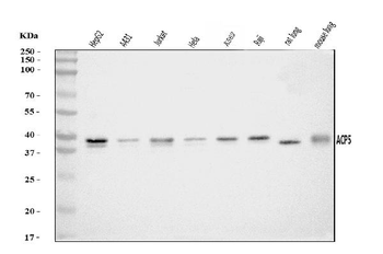 Acid phosphatase/ACP5 Antibody