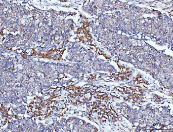 PACAP-38/ADCYAP1/PACAP Rabbit Polyclonal Antibody