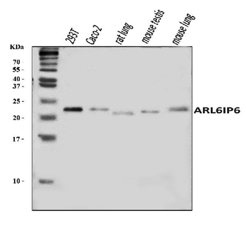 ARL6IP6 Rabbit Polyclonal Antibody