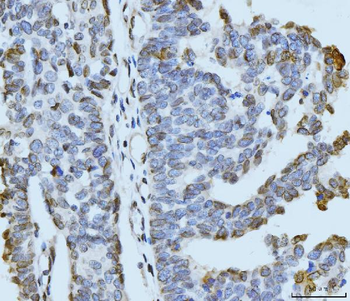 ARL6IP6 Rabbit Polyclonal Antibody