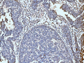 ARL6IP6 Rabbit Polyclonal Antibody