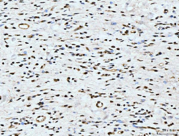 ARL6IP6 Rabbit Polyclonal Antibody