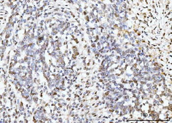 ARL6IP6 Rabbit Polyclonal Antibody