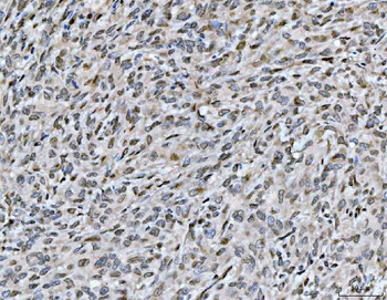 ARL6IP6 Rabbit Polyclonal Antibody