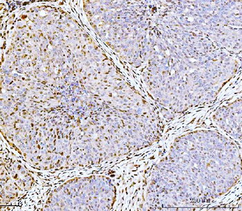 ARL6IP6 Rabbit Polyclonal Antibody