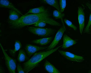 BHMT Rabbit Polyclonal Antibody