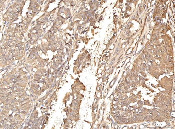 BHMT Rabbit Polyclonal Antibody