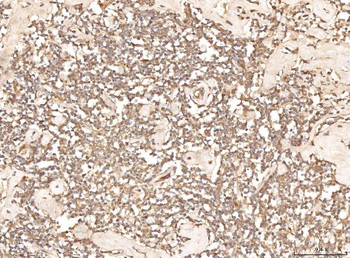 BHMT Rabbit Polyclonal Antibody