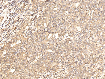 BHMT Rabbit Polyclonal Antibody