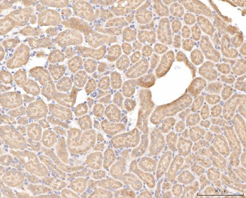 BHMT Rabbit Polyclonal Antibody