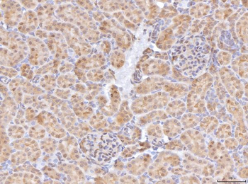 BHMT Rabbit Polyclonal Antibody