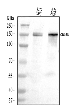 CD163 Rabbit Polyclonal Antibody