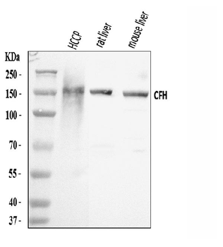 Factor H/CFH Antibody