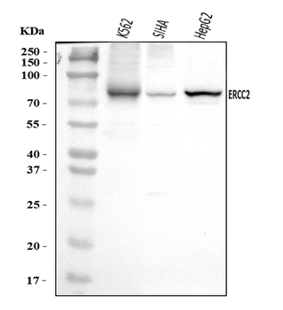 XPD/ERCC2 Rabbit Polyclonal Antibody