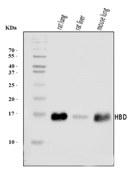 HBD Rabbit Polyclonal Antibody