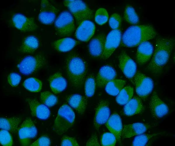 HSPA6 Rabbit Polyclonal Antibody