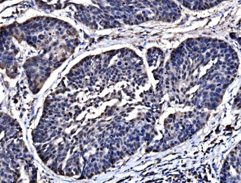 HSPA6 Rabbit Polyclonal Antibody