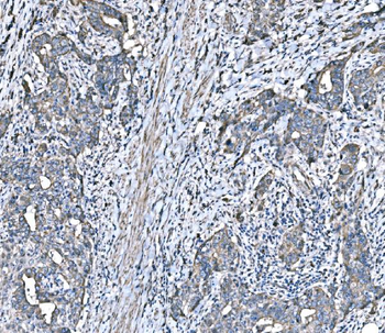 HSPA6 Rabbit Polyclonal Antibody