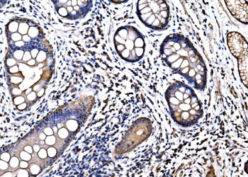 HSPA6 Rabbit Polyclonal Antibody