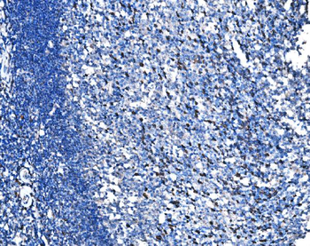 HSPA6 Rabbit Polyclonal Antibody