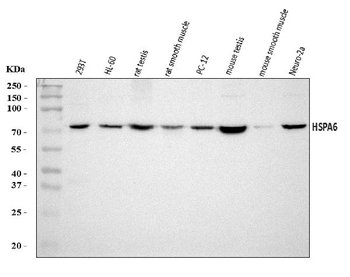 HSPA6 Rabbit Polyclonal Antibody