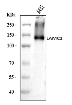LAMC2 Rabbit Polyclonal Antibody